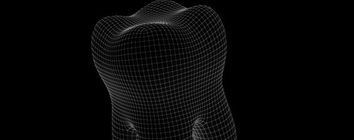 Planning the Digital Bite Lift