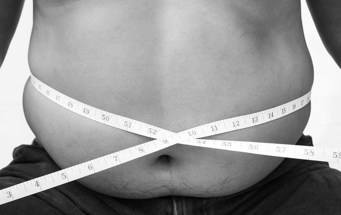 Big Patients, Big Consequences: Obesity and the Implications for Dentistry