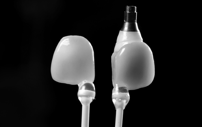COMPLICATIONS, DESIGN CONSIDERATIONS AND MAINTENANCE FOR IMPLANT SUPPORTED PROSTHESES 