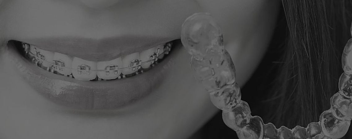 Practical Orthodontic Considerations For Oral Rehabilitation With The Invisalign Appliance