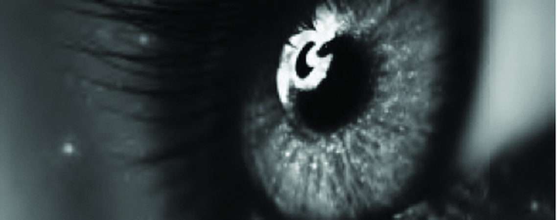 Immediate Dentoalveolar Restoration (IDR) — Immediate-loaded Implants in Compromised Sockets.