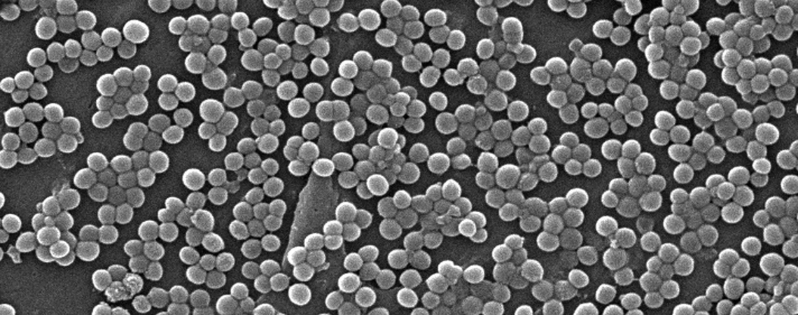 Emerging Diseases and Infection Control