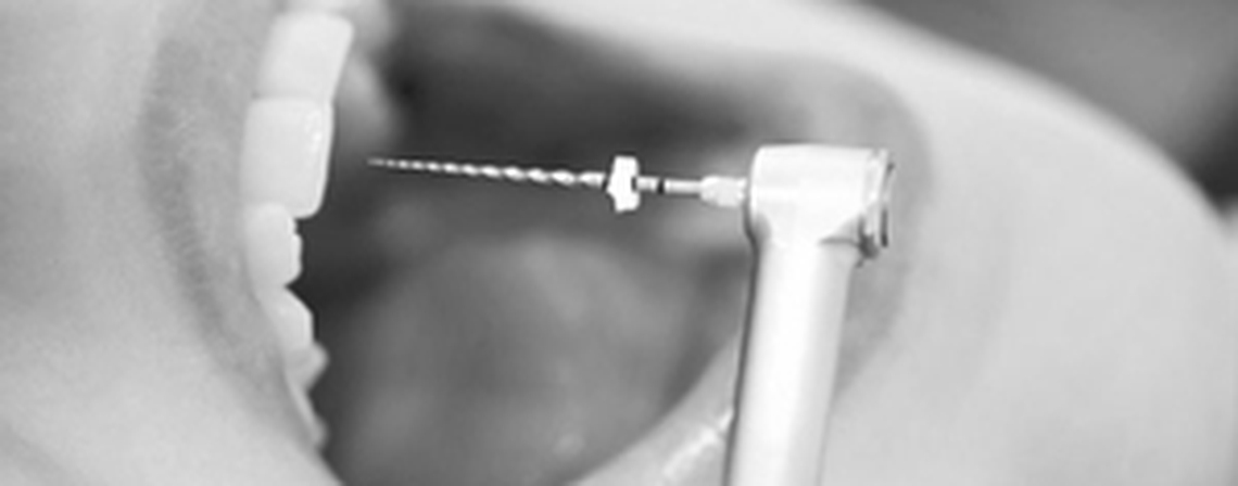 Endodontic Problem Solving