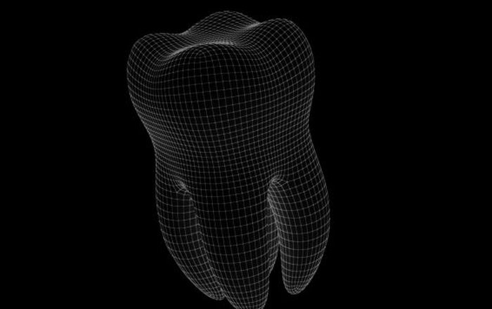 Planning the Digital Bite Lift