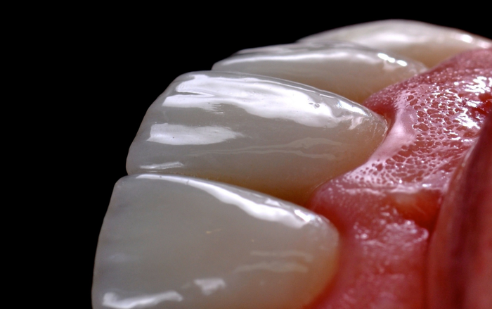 Mastering Tooth Preparation and Bonding of Ceramic Restorations: Crowns, Veneers and On-Lays