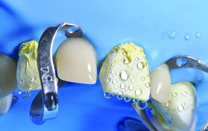 RUBBERDAMOLOGY AND ADVANCED PHOTOGRAPHY