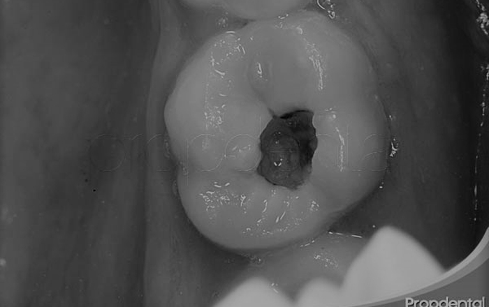 The Puzzle Pieces of Risk: Putting CAMBRA to Work in Your Practice